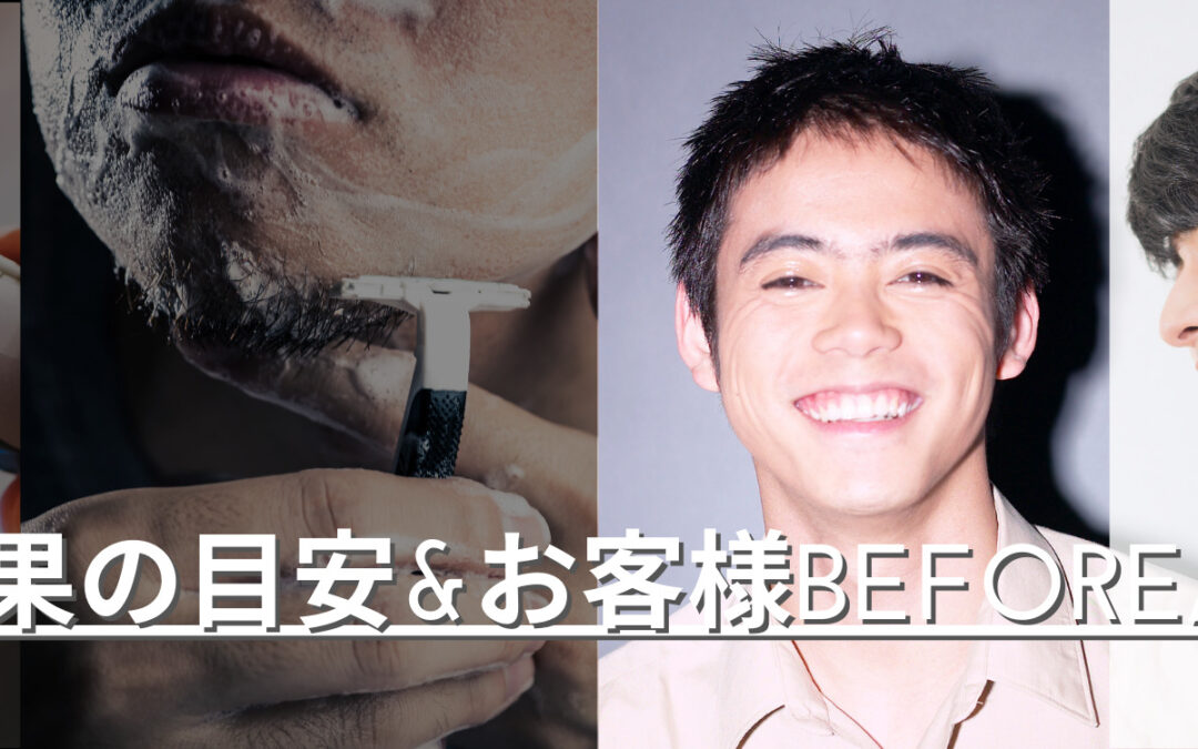 脱毛の効果目安&Before/Afterページ追加について