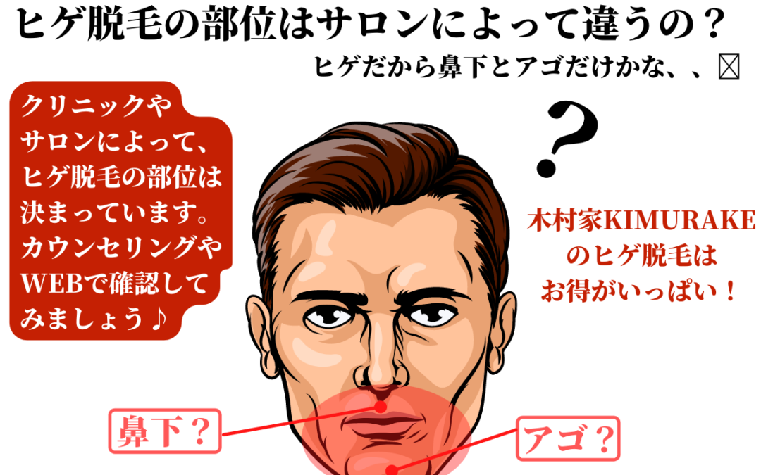 ヒゲ脱毛の部位はサロンによって違うの？