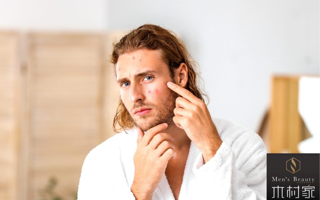 もうニキビで悩みたくない！