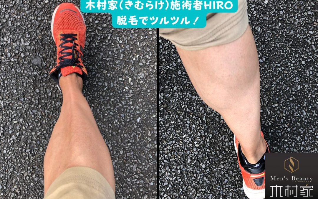 あなたの足の毛、大丈夫ですか？周りから見られてますよ！