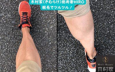 あなたの足の毛、大丈夫ですか？周りから見られてますよ！
