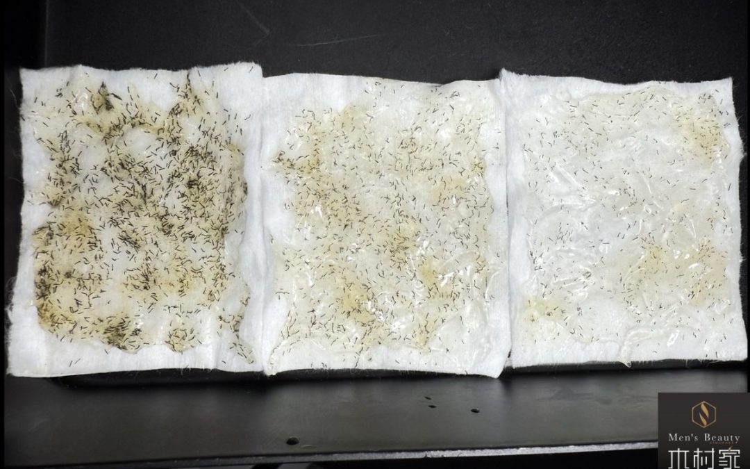 大量のポップアップで驚いた！