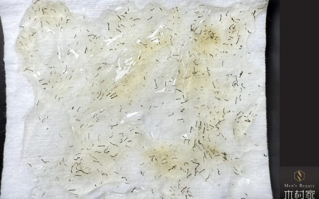 肌の色が濃い方でも爆抜けします