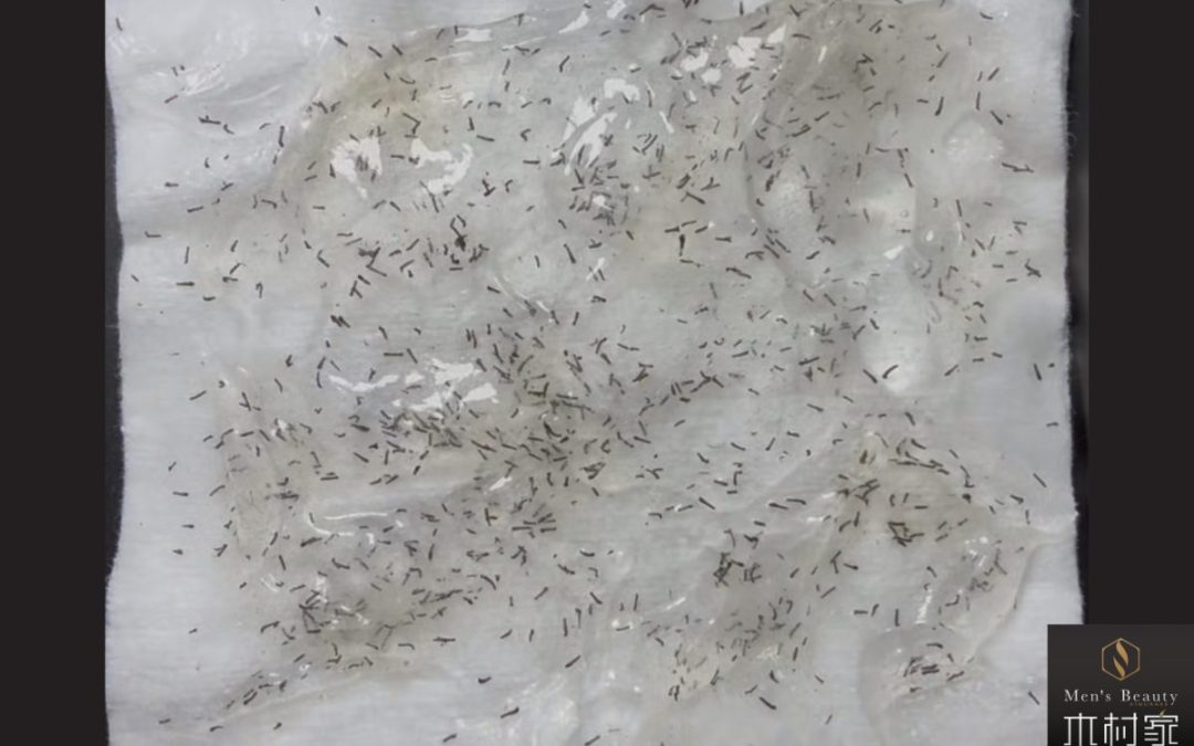 脱毛された方が100%言われる御言葉を頂戴しました