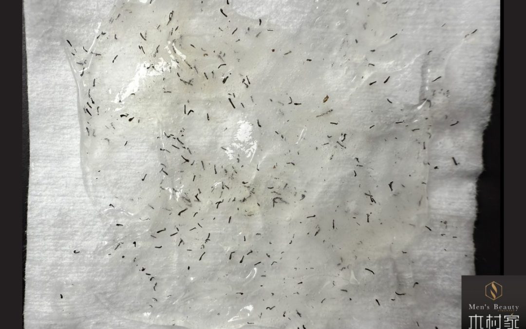 爆抜けの多さに驚いておられました！