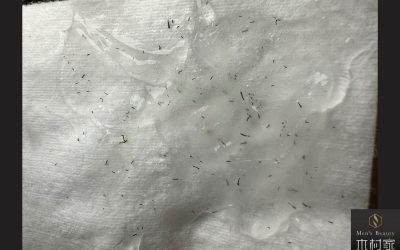 痛みに弱い方でも爆抜けします！