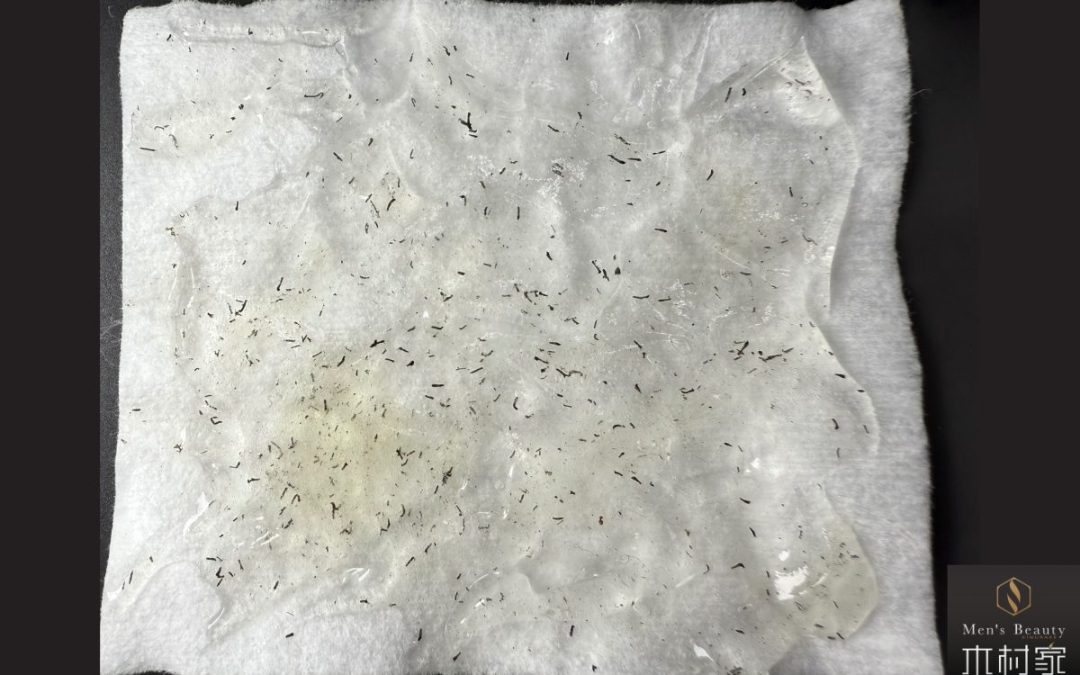 医療以外でこんなに抜けるとは思わなかった