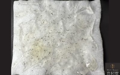 医療以外でこんなに抜けるとは思わなかった
