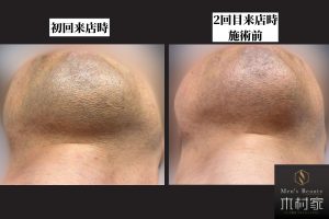 初回の効果で2回目来店が待ち遠しかった