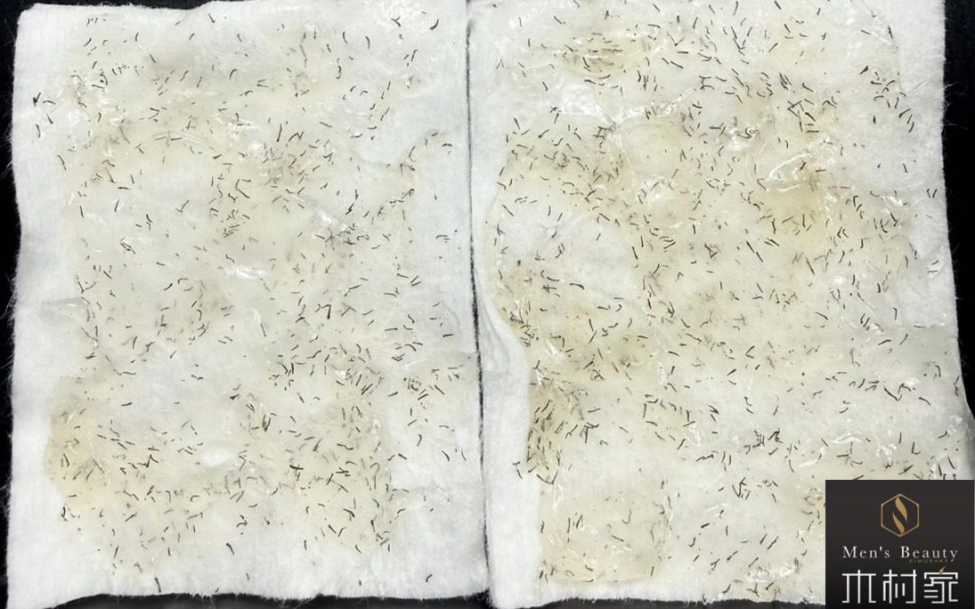 爆抜けのポップアップ！