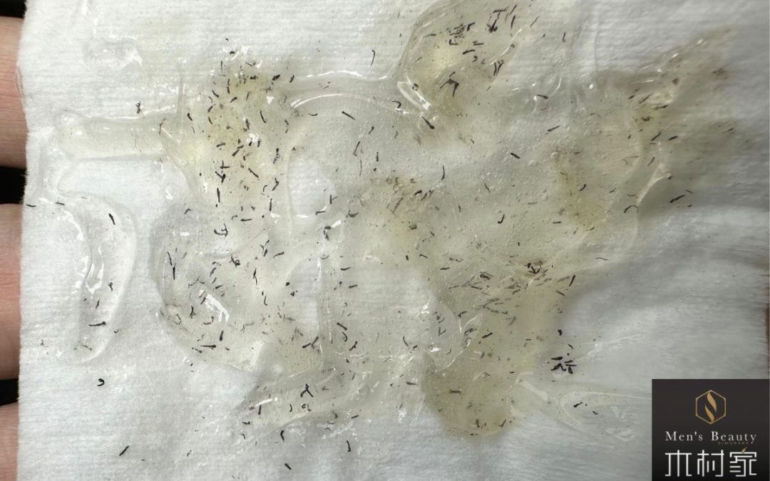 まだこんなに髭があったんですか！？