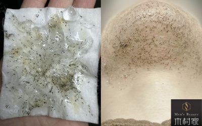 大量のポップアップで驚いた！