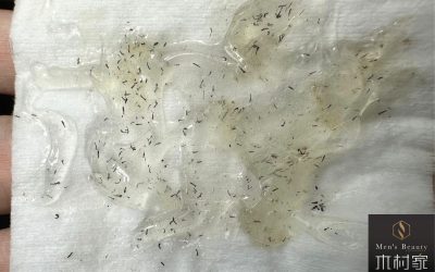 まだこんなに髭があったんですか！？